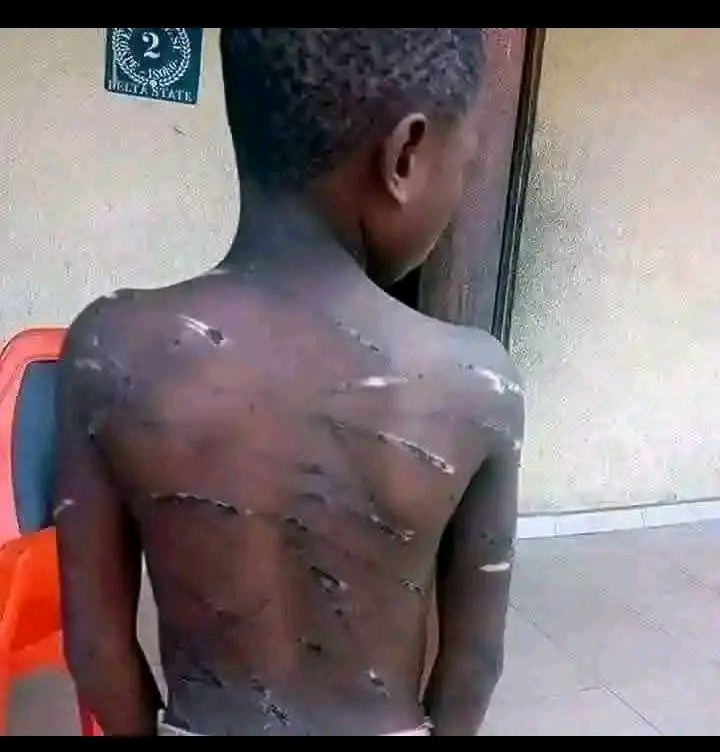 Couples arrested for abusing step son.