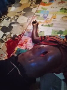 45-YEAR-OLD FARMER DIES BY GUNSHOT IN TEWIA COMMUNITY IN ATIWA EAST